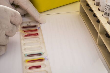 Blood test, labの写真素材