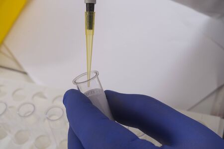 Laboratory blood testの写真素材