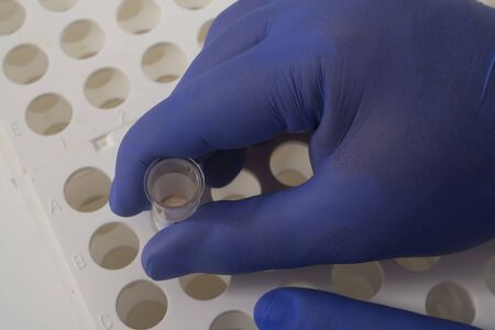 Laboratory blood testの写真素材