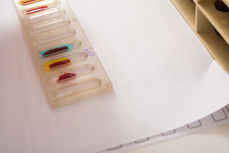 blood testの写真素材