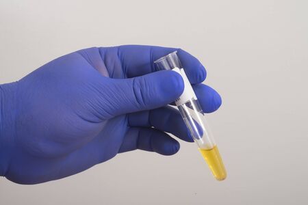 Test tube