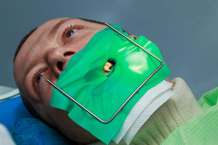 Dentist very carefully check up and repair tooth of his young patientの写真素材