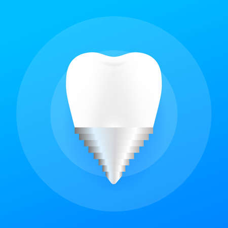 Crown Implant Tooth Icon. Human dental implant. Vector stock illustration.