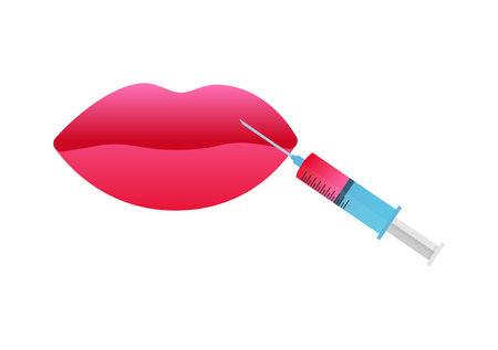 Botox or hyaluronic acid injection. Contour plastic. Vector stock illustration.のイラスト素材