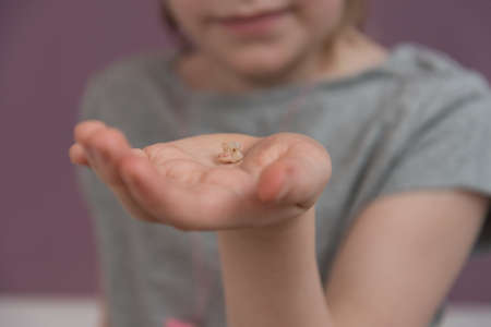The child holds a lost tooth in his hand. There are traces of caries on the tooth. Removal of a tooth. Loss of a milk toothの写真素材