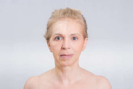 Before and after beauty shot in skin treatmentsの写真素材