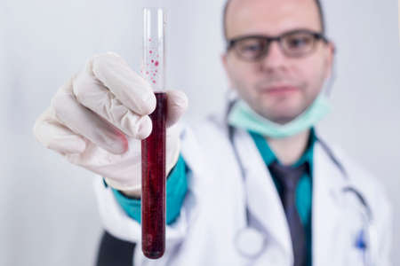 Doctor showing a blood glassの写真素材
