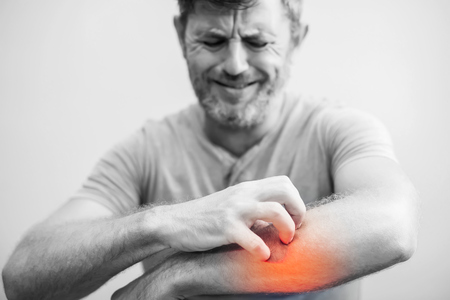 People scratch the itch with hand, Elbow, itching, Healthcare And Medicine, Men with skin problem...