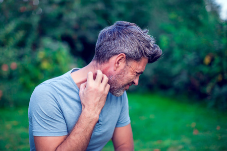 People scratch the itch with hand outdoor, Elbow, itching, Healthcare And Medicine, Men with skin problem conceptの写真素材