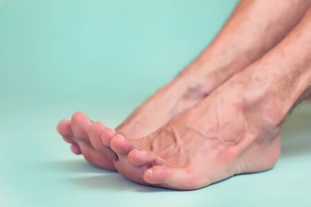 Man's foot isolated. People, healthcare and medicine concept