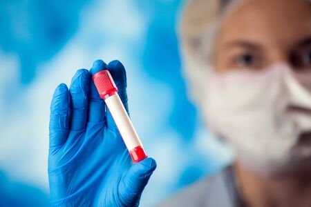 Female doctor holding test tube with blood. Covid-19. Coronavirus. Medicine, laboratory and healthcare conceptの写真素材