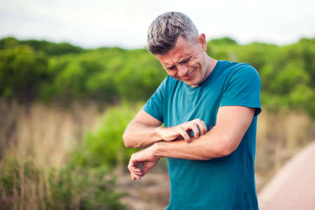 Allergy or mosquito bite. Man scratcing arm outdoor. Healthcare and medicine conceptの写真素材