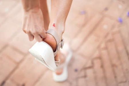 Callus on the heel of woman outdoor. Healthcare and medicine conceptの写真素材