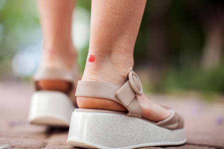 Callus on the heel of woman outdoor.の写真素材