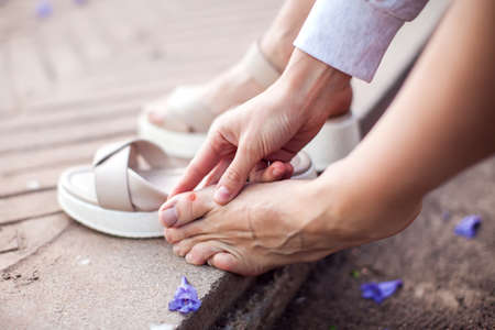 Callus on the heel of woman outdoor. Healthcare and medicine conceptの写真素材