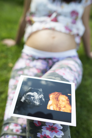 Pregnant women hold picture of womb. Daylight in the gardenの写真素材