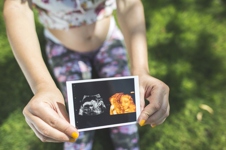 Pregnant women hold picture of womb. Daylight in the gardenの写真素材