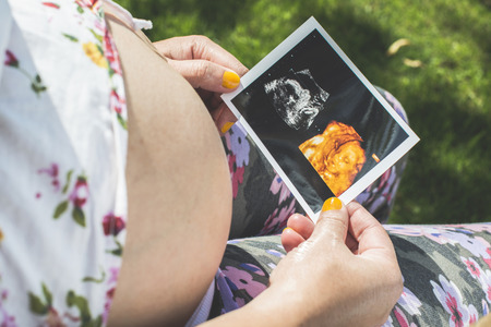 Pregnant women hold picture of womb. Daylight in the gardenの写真素材