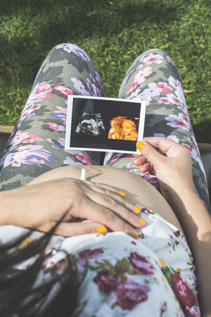 Pregnant women hold picture of womb. Daylight in the gardenの写真素材
