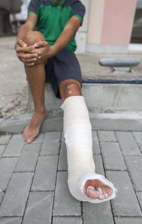 Boy have his leg broken. Gypsum footの写真素材