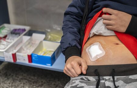 Young teenage boy in hospital. Child with cut wound in medical cabinet in hospital. Kid shows belly wound. Concept for wound from surgery.の写真素材