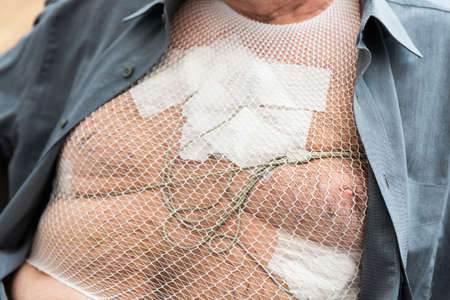 Portable holter for cardiac monitoring of electrical activity of the cardiovascular system attached to a male senior patient's chest during a 24 hour diagnostics processの写真素材