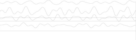 Brainwaves chart with eeg patterns for neurological study and analysis.