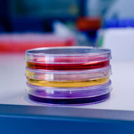 Tower of petri dishes with different dyes and tests. Concept of science, laboratory and study of diseases.の写真素材