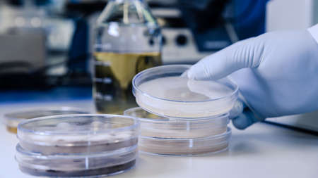 Scientific handling Microbiological cultures in a petri dish for pharmaceutical bioscience research....