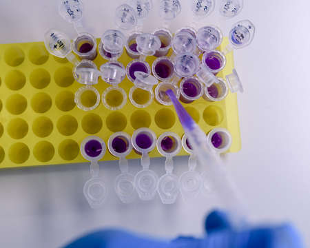 Scientist working with a pipette and a flask, in plastic tubes for DNA studies. Concept of science,...
