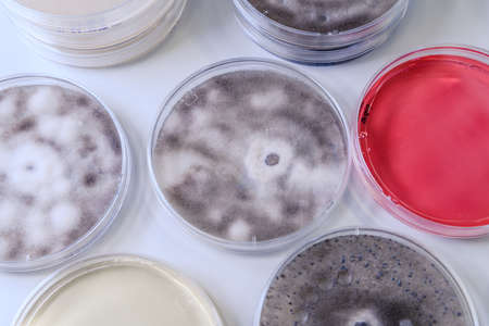 Microbiological culture in a petri dish for pharmaceutical bioscience research. Concept of science, laboratory and study of diseases. Coronavirus (COVID-19) treatment developing.の写真素材
