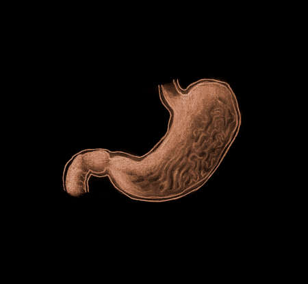 stomachの写真素材