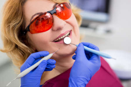 close up portrait of cheerful mature woman in dental clinicの写真素材