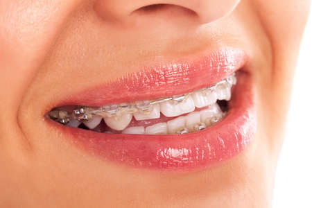 Beautiful denture close up isolatedの写真素材