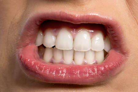 Funny pose mouth with beautiful white teethの写真素材