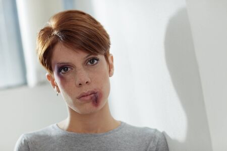 portrait of young caucasian woman being abused. Horizontal shape, front view, copy spaceの写真素材