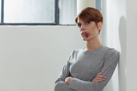 portrait of young caucasian woman being abused. Horizontal shape, front view, copy space