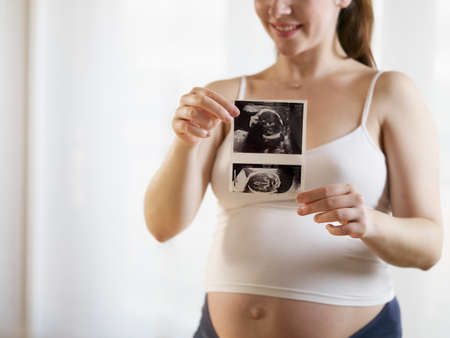 Young Pregnant Woman Showing Medical Baby Scansの写真素材