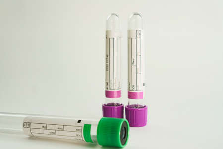 vacuum tubes for collection and blood samples on white background. Transparent with purple and green...