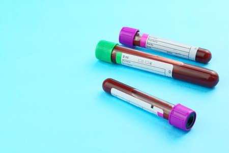 Vacuum tubes for collection and blood samples on blue background. Transparent with purple and green lid. Label to identify the data. Selective focus.の写真素材