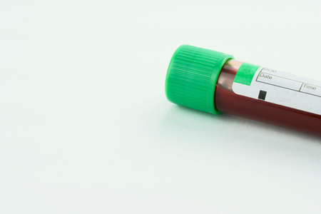 Vacuum tube for collection and blood samples on white background. Transparent with green cap. Label...