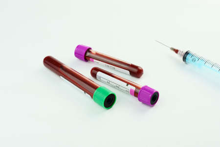 Vacuum tubes for collection and blood samples on white background. Transparent with purple and green...