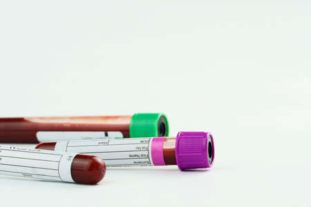 Vacuum tubes for collection and blood samples on white background. Transparent with purple and green...