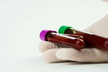 Hand with surgical glove holding vacuum tubes for collection and blood samples on white background. Transparent with purple and green cap and a syringe. Label to identify the data. Selective focus.の写真素材