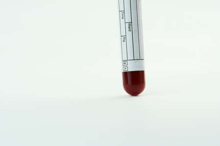 Vacuum tube for collection and blood samples on white background. Label to identify the data....
