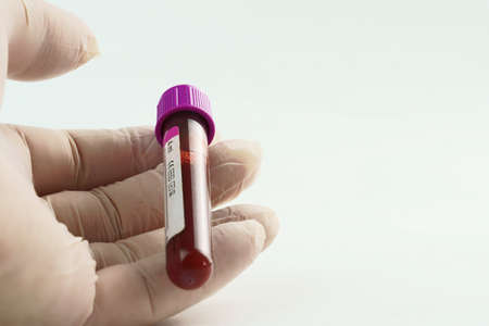 Hand with surgical glove holding vacuum tube for collection and blood samples on white background. Transparent tube with purple lid and label to identify the data. Selective focus.の写真素材