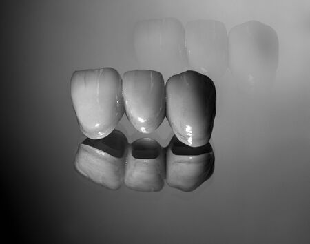 Zircon teeth bridgeの写真素材