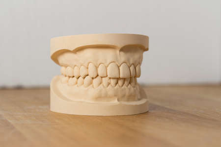 Dental mold showing a full set of teeth on a wooden table viewed side-on in a dentistry, oral...