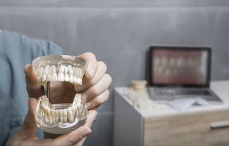 Gloved hands of man showing the a transparent model of human gums and teeth with laptop and desk in...