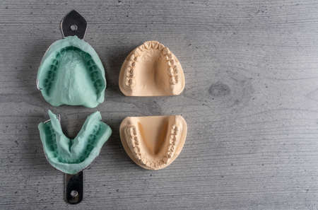 Set of upper and lower jaw dental molds on a grey wooden surface with copy space in a conceptual imageの写真素材